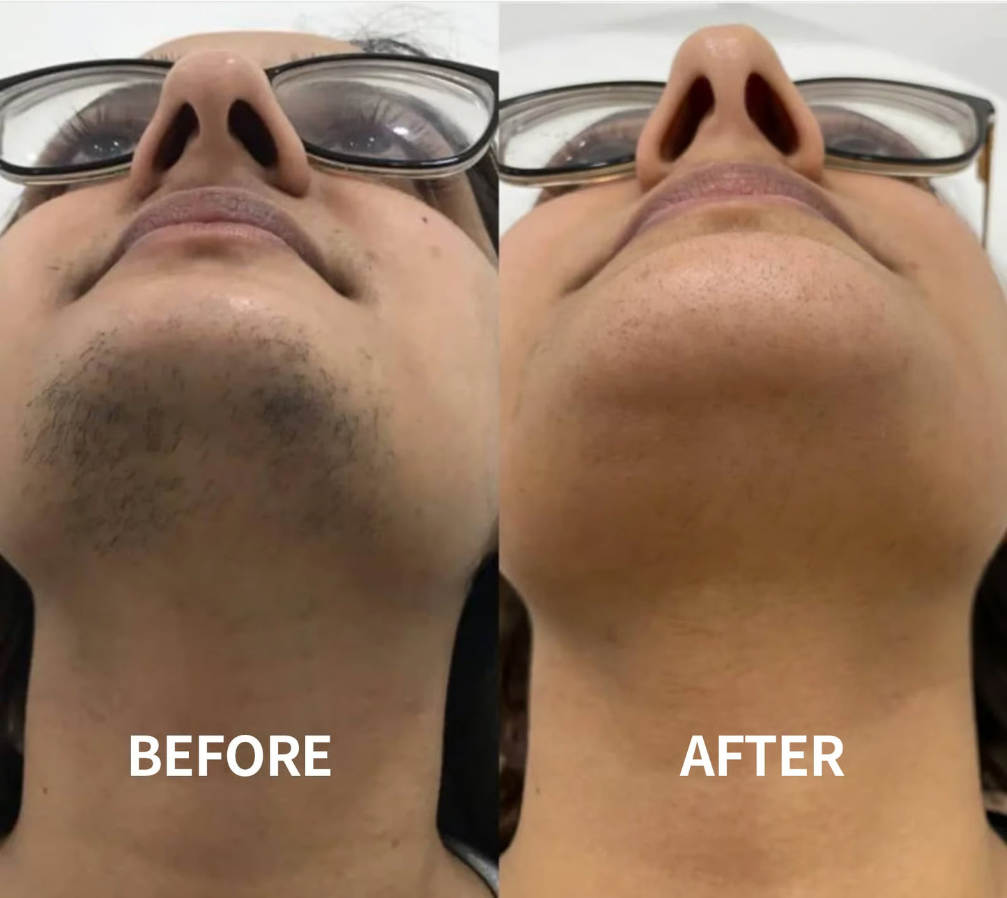 The SmoothSculpt Hair Removal Cream - Painless, Non-Irritating, and Fast + BUY 1 GET 1 FREE
