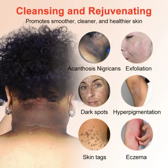 The GlowPeel™ Exfoliating Gel - Brighter, Clearer Skin in One Wipe + 50% OFF
