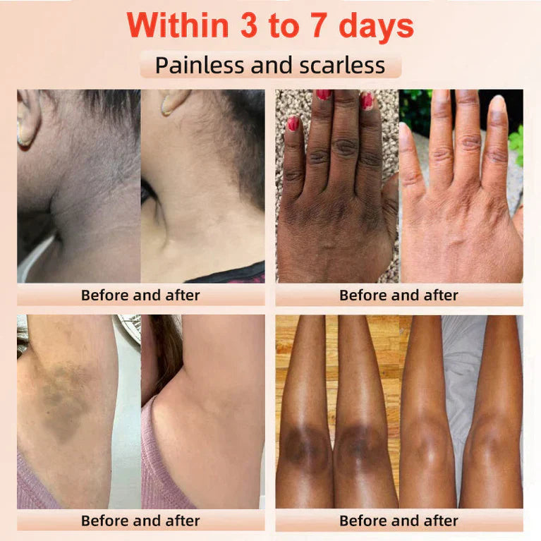 The GlowPeel™ Exfoliating Gel - Brighter, Clearer Skin in One Wipe + 50% OFF