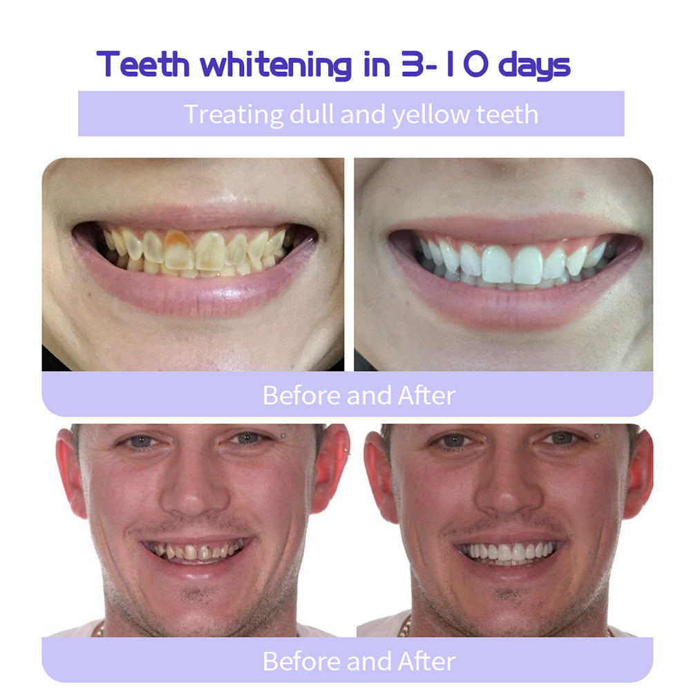 DENTASHIELD – Restore Your Natural Dental Bio-Barrier + 50% OFF FLASH SALE