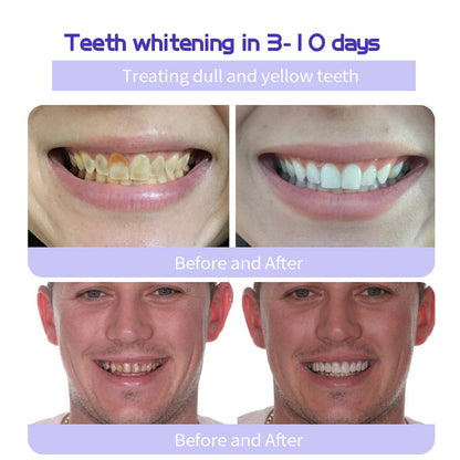 DENTASHIELD – Restore Your Natural Dental Bio-Barrier + 50% OFF FLASH SALE