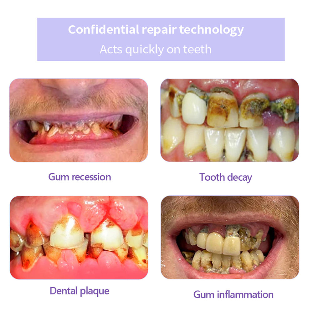 DENTASHIELD – Restore Your Natural Dental Bio-Barrier + 50% OFF FLASH SALE