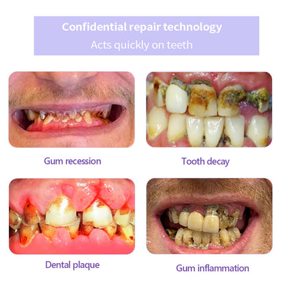DENTASHIELD – Restore Your Natural Dental Bio-Barrier + 50% OFF FLASH SALE