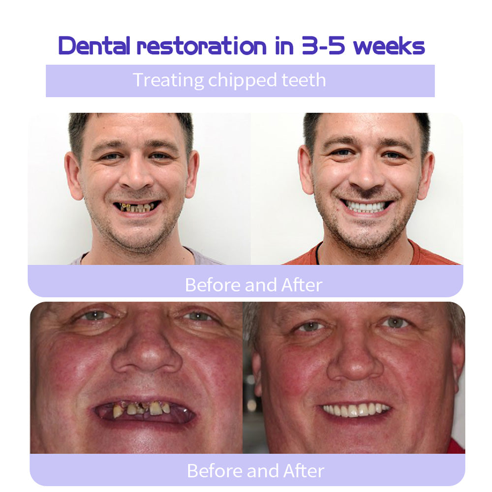 DENTASHIELD – Restore Your Natural Dental Bio-Barrier + 50% OFF FLASH SALE