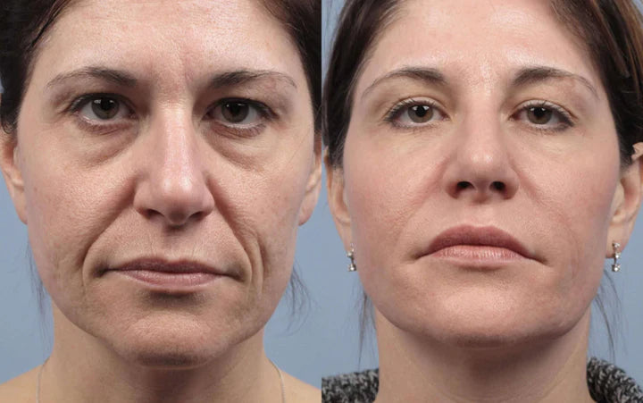 The Renewing 10s Instant-Lift Serum – Fast-Acting Lift for a Noticeably Younger Look in Seconds + 50% OFF