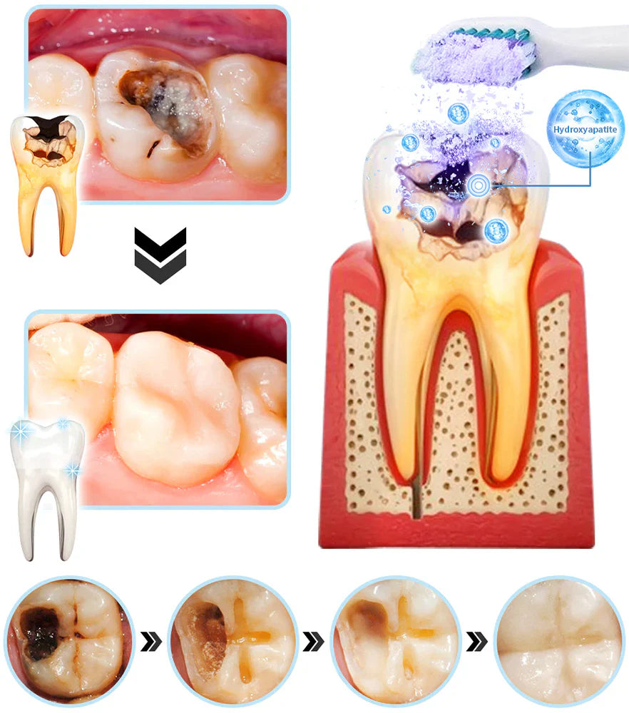 DENTASHIELD – Restore Your Natural Dental Bio-Barrier + 50% OFF FLASH SALE