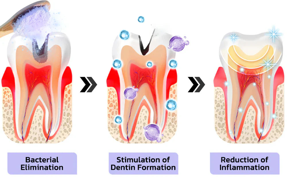 DENTASHIELD – Restore Your Natural Dental Bio-Barrier + 50% OFF FLASH SALE