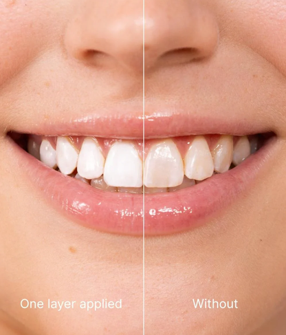 DentalGlow - Instant Radiance For Brighter, Smoother Enamel + 50% OFF