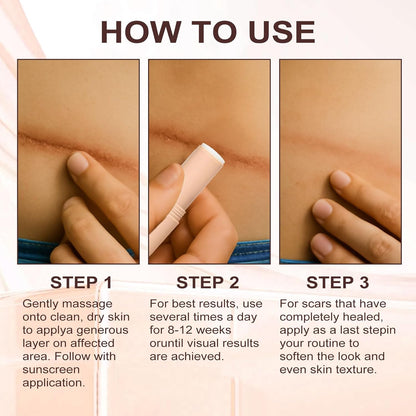 The AuraSmooth Scar Stick - 60% Medical-Grade Silicone, Centella Asiatica, and 100% Satisfaction Guarantee +50% OFF