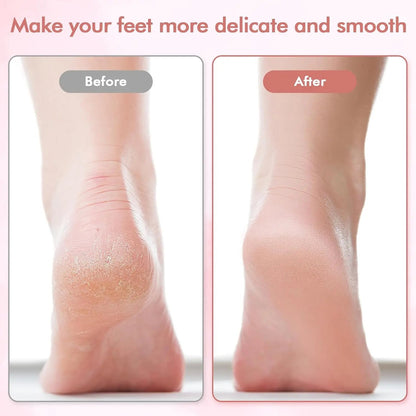 The SilkStep Pro – Salon-Smooth Feet in Minutes, Safe & Painless Technology + 50% OFF