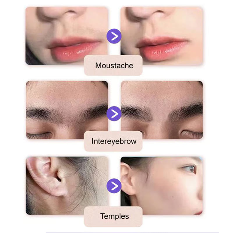 SilkyEase Precision Cream- 50 % OFF