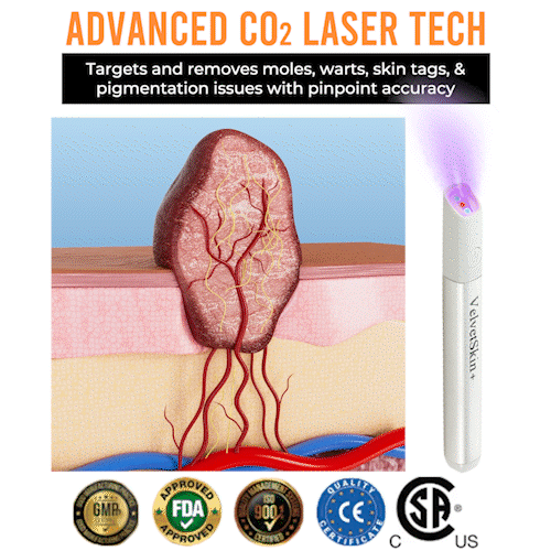 DermaBeam Pro – Erase Skin Flaws Instantly + 50% OFF