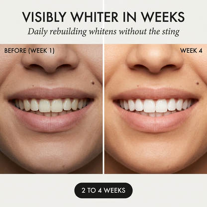 Nacara™ – Fluoride-Free Hydroxyapatite Whitening Toothpaste for Sensitive Teeth + 50% OFF