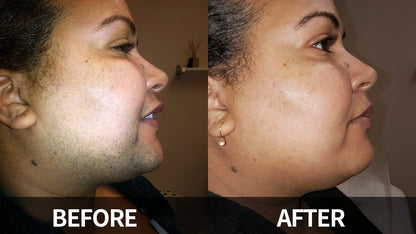 SilkyEase Precision Cream- 50 % OFF