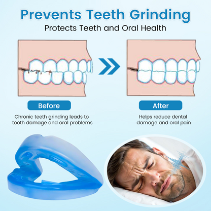 SilentRest™ Anti-Snoring & Anti-Grinding Teeth Protector