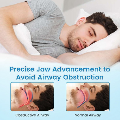 SilentRest™ Anti-Snoring & Anti-Grinding Teeth Protector